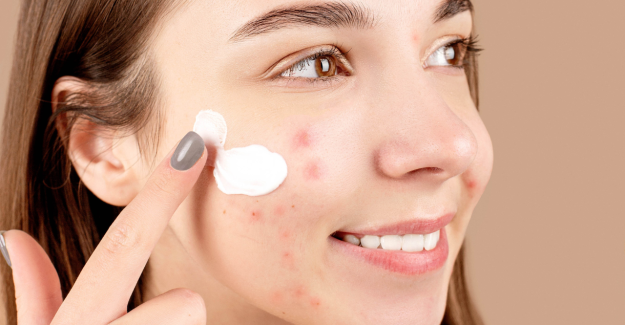 Acne, cos'è e come combatterla