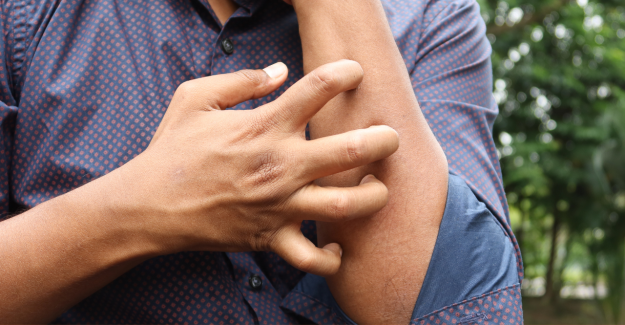 Punture di insetti: come prevenirle e trattarle correttamente